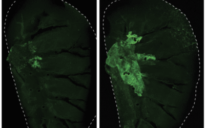 Científicos hallan «células mutantes» que serían el origen del cáncer de pulmón